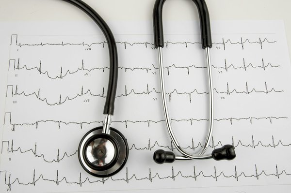 Formation ecg en ligne : déchiffrez les rythmes cardiaques